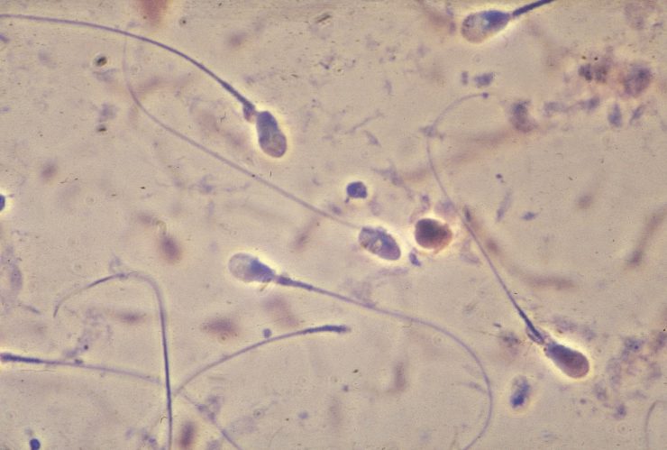 Spermien mikroskop Wie groß